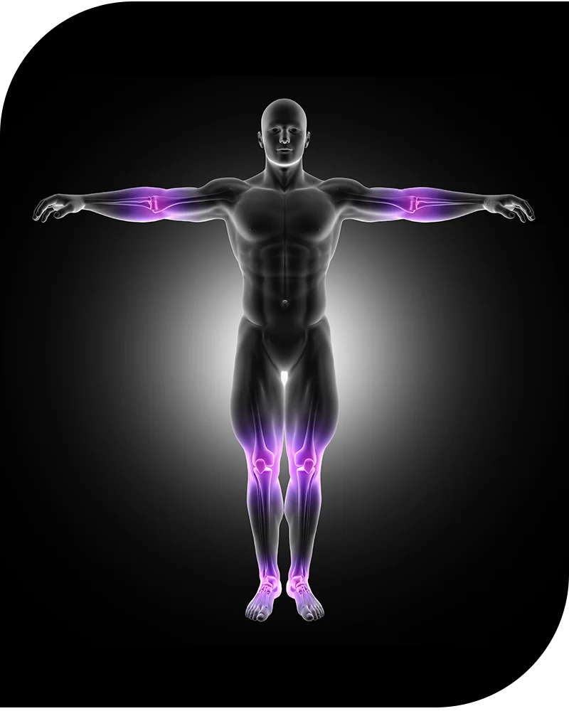 آرتروگرافی