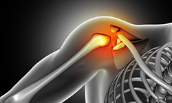 ام آر آرتروگرافی مفصل شانه