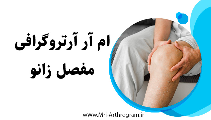 ام آر آرتروگرافی از مفصل زانو