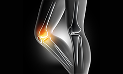 ام آر آرتروگرافی مفصل زانو