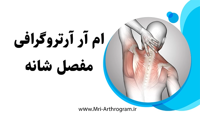 ام آر آرتروگرافی مفصل شانه 